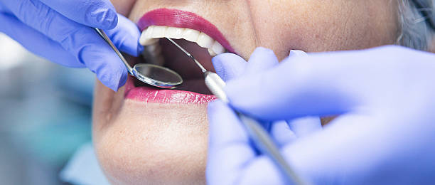Best Knocked-Out Tooth (Avulsed Tooth) Treatment in Aiea, HI